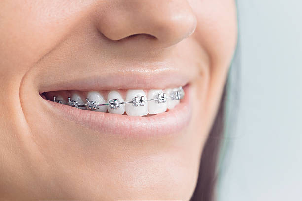 Dental X-Rays and Imaging in Apple Creek, OH